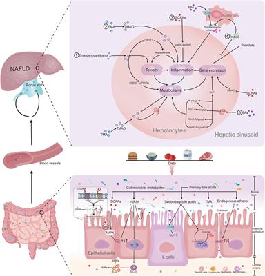 Microbial Metabolites: Critical Regulators in NAFLD